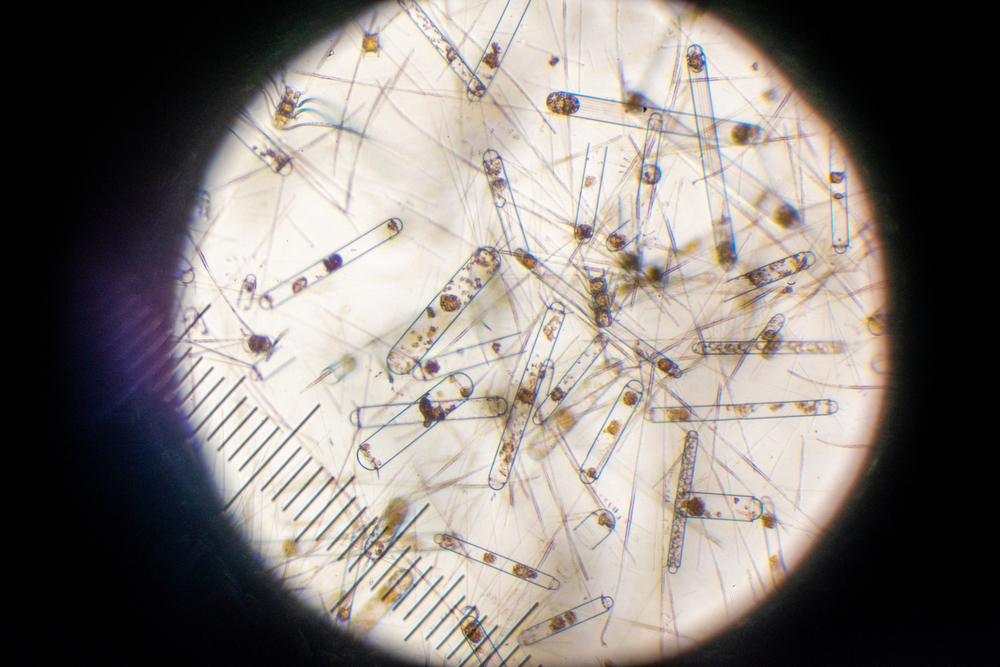 tan2101 01 29 compound microscope bongo DSC2439
